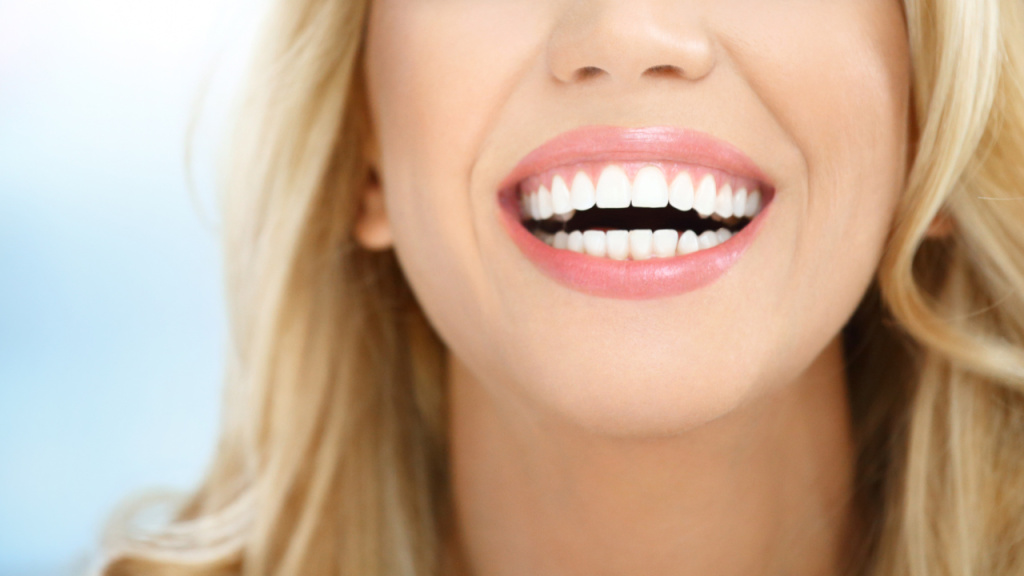 hollywood smile