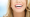 hollywood smile